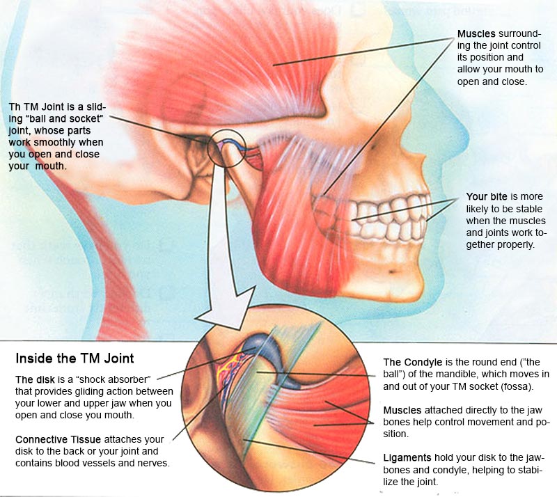 TMJ - strained jaw muscles and joints