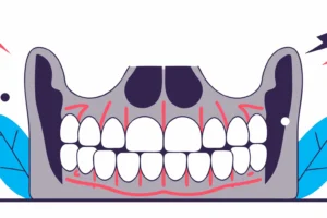 Bruxism vs TMJ Disorder: Key Differences and Treatment Options