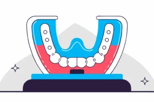 What Is a Mandibular Advancement Device? A Guide